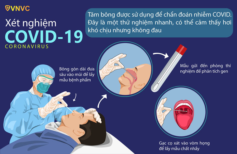 KẾ HOẠCH - Thực hiện xét nghiệm sàng lọc vi rút SARS-COV-2 trong phòng, chống dịch Covid-19 trên địa bàn toàn tỉnh Kiên Giang